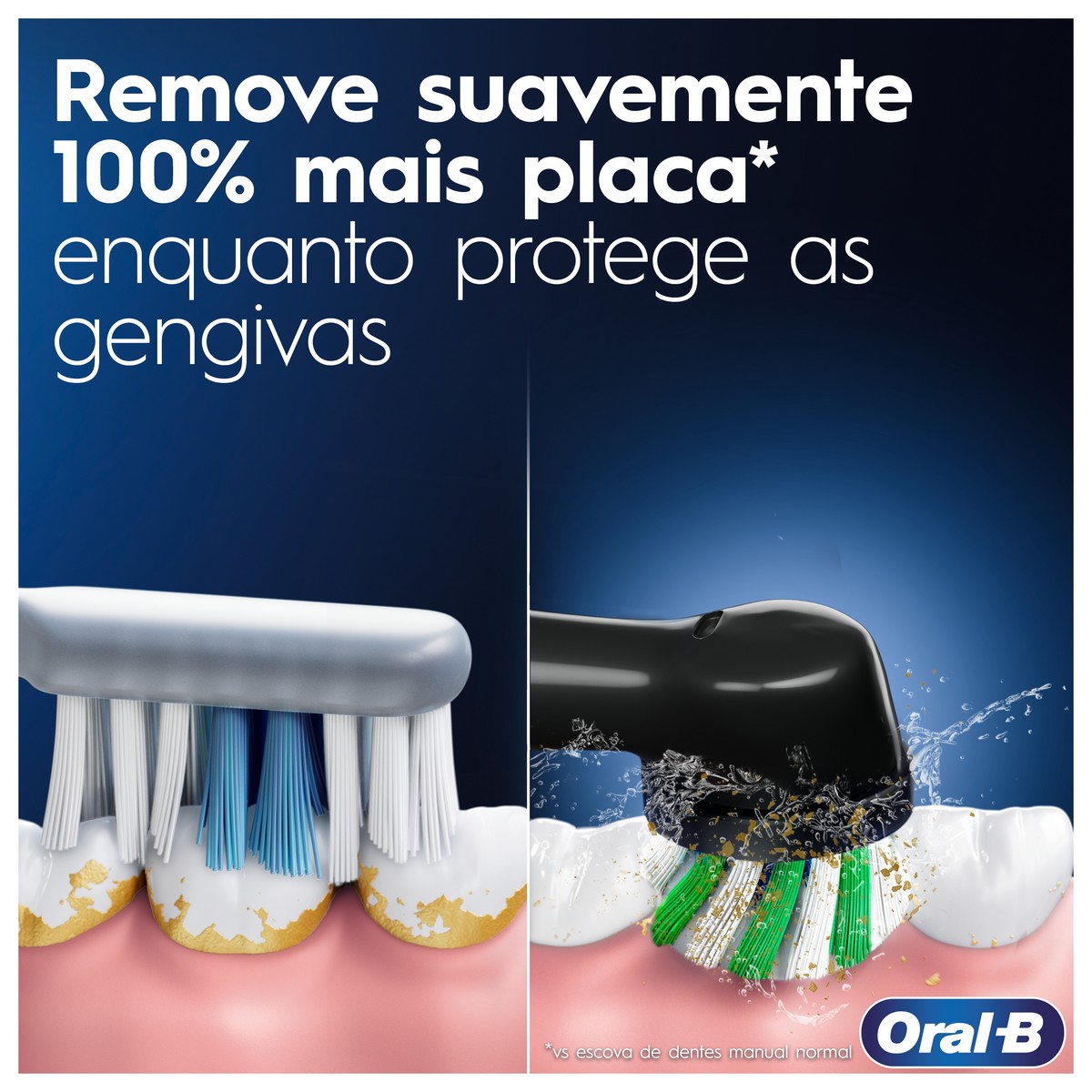 Escova de Dentes Elétrica Oral-B Braun Pro Series 1 - 1 Unidade - Rosa Rosa-2