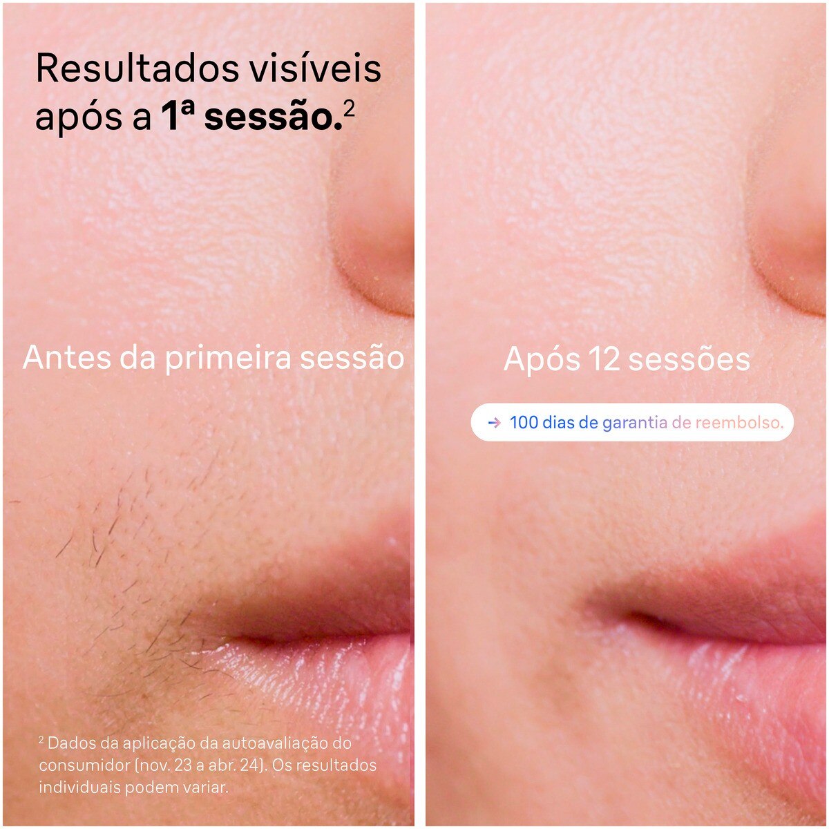 Depiladora de Luz Pulsada IPL Braun Silk Expert S7 PL7147 para Corpo e Rosto - Branco e Bronze Branco / Bronze-4