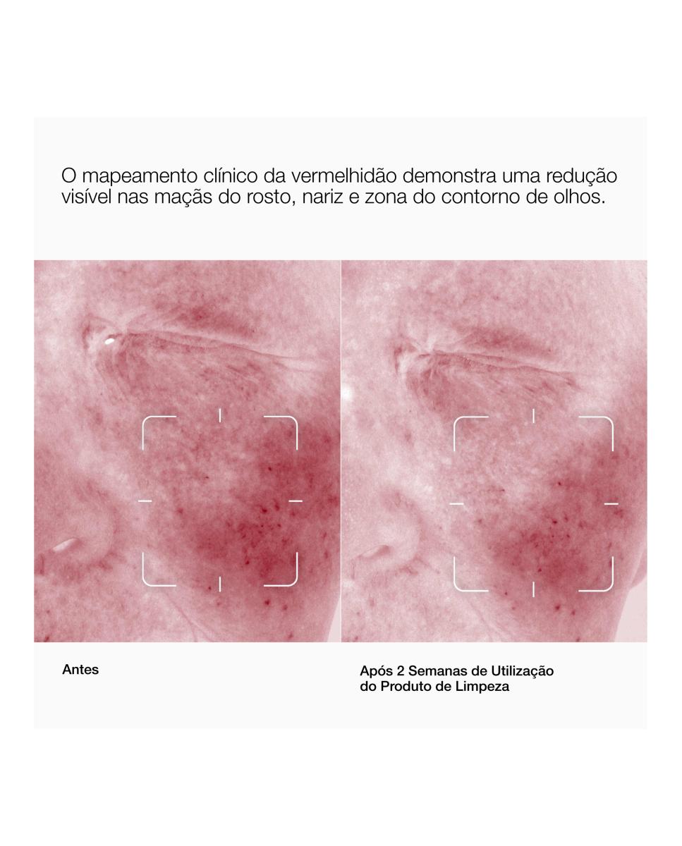 Creme de Limpeza Daily Calm™ 4
