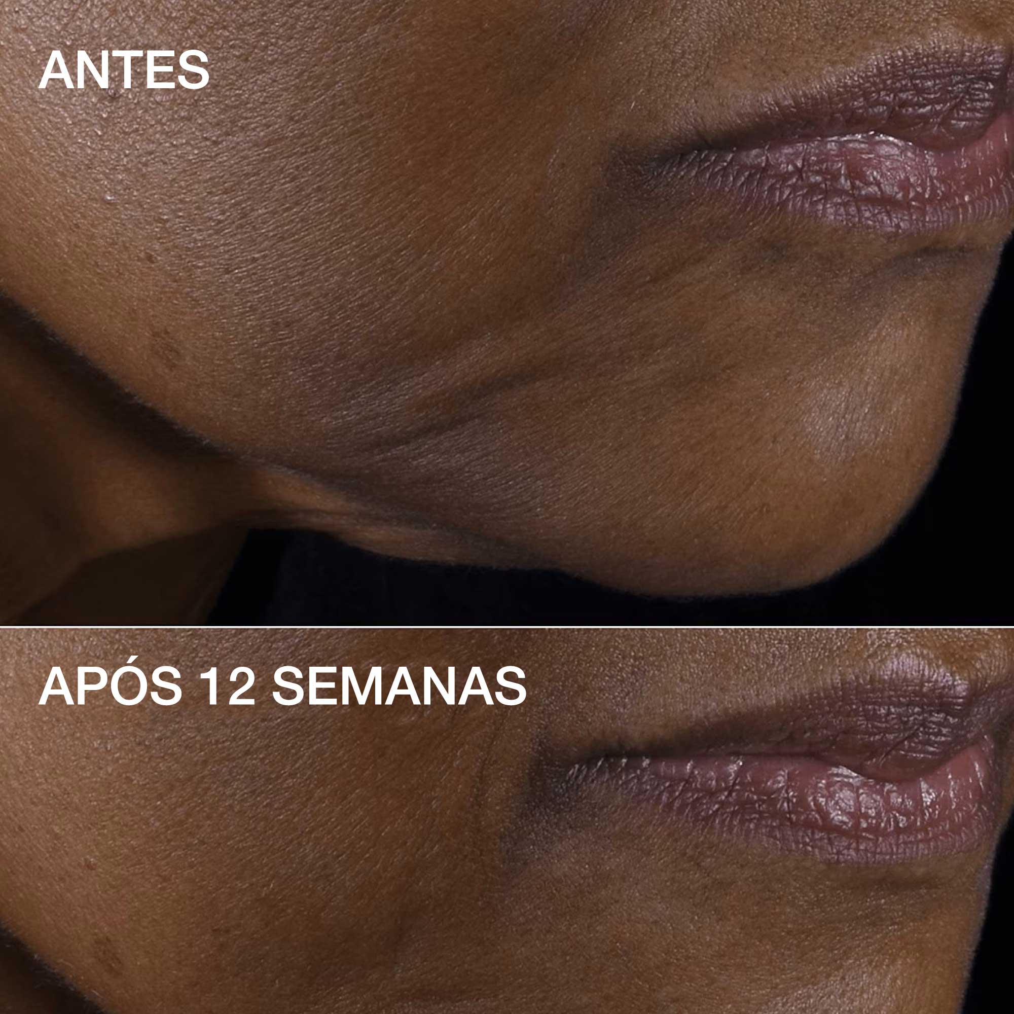 Smart Clinical Repair™ Lifting Face + Neck Cream 6