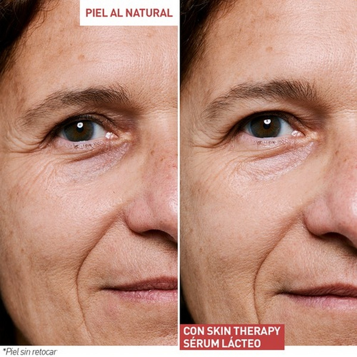 Sérum Lácteo Skin Therapy 5