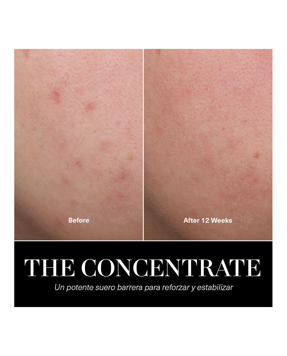 The Concentrate - 15 ml 8
