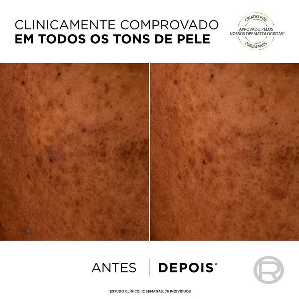 Fluído Hidratante Anti-manchas SPF50+ e Niacinamida Bright Reveal - 50 ml 4