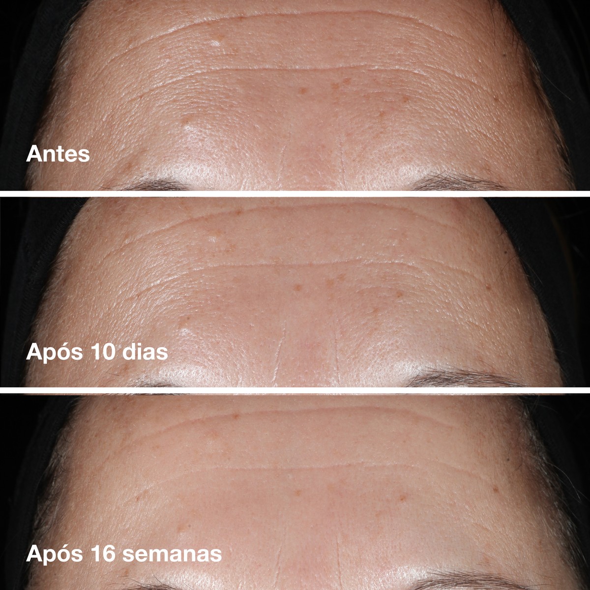 Sérum Smart Clinical Repair™ Wrinkle Correcting Serum 30ml Clinique 3