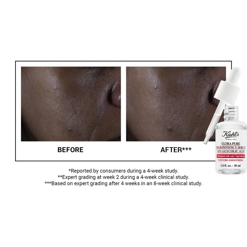 Ultra Pure High-Potency Serum 9.8% Glycolic Acid - 30 ml 5