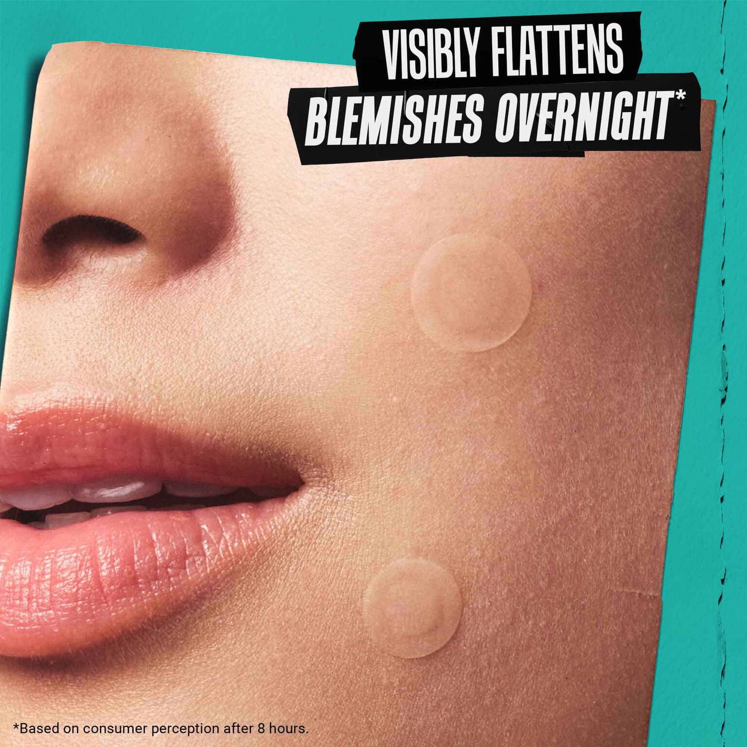 Truly Targeted Overnight Blemish Patch 3