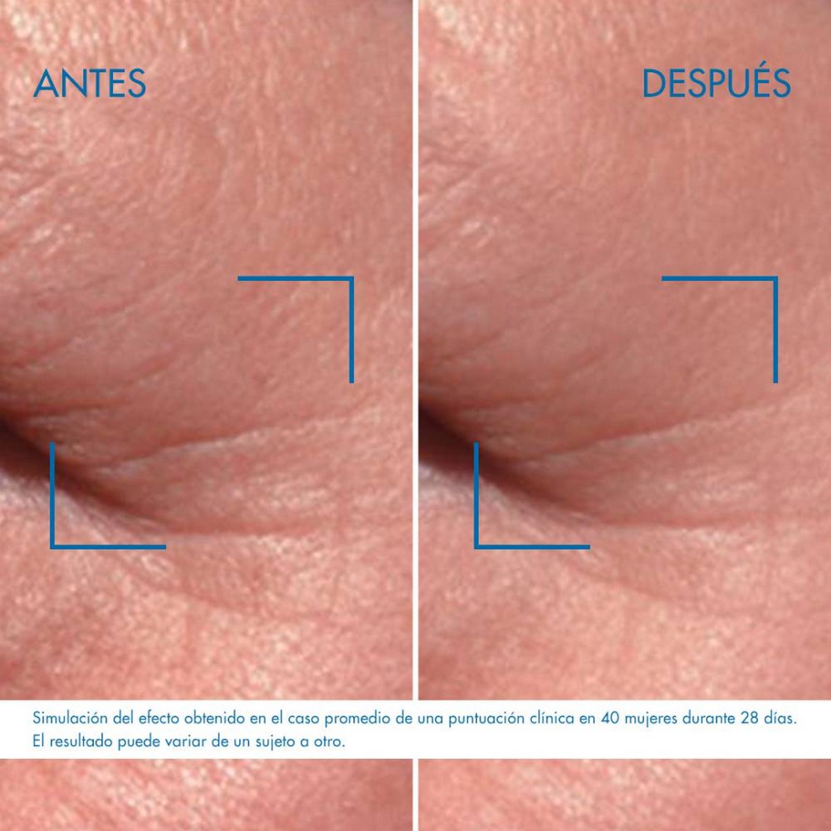 Contorno de Olhos Blue Retinol - 15 ml 5