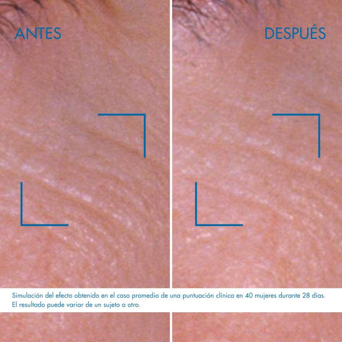 Contorno de Olhos Blue Retinol - 15 ml 9