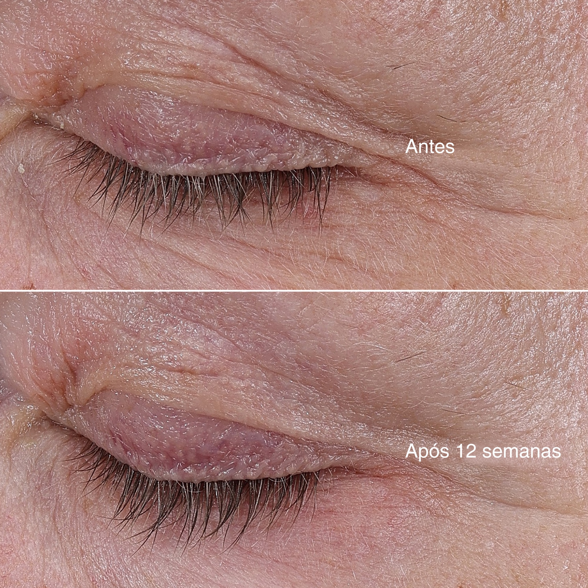 The Rejuvenating Eye Cream 6