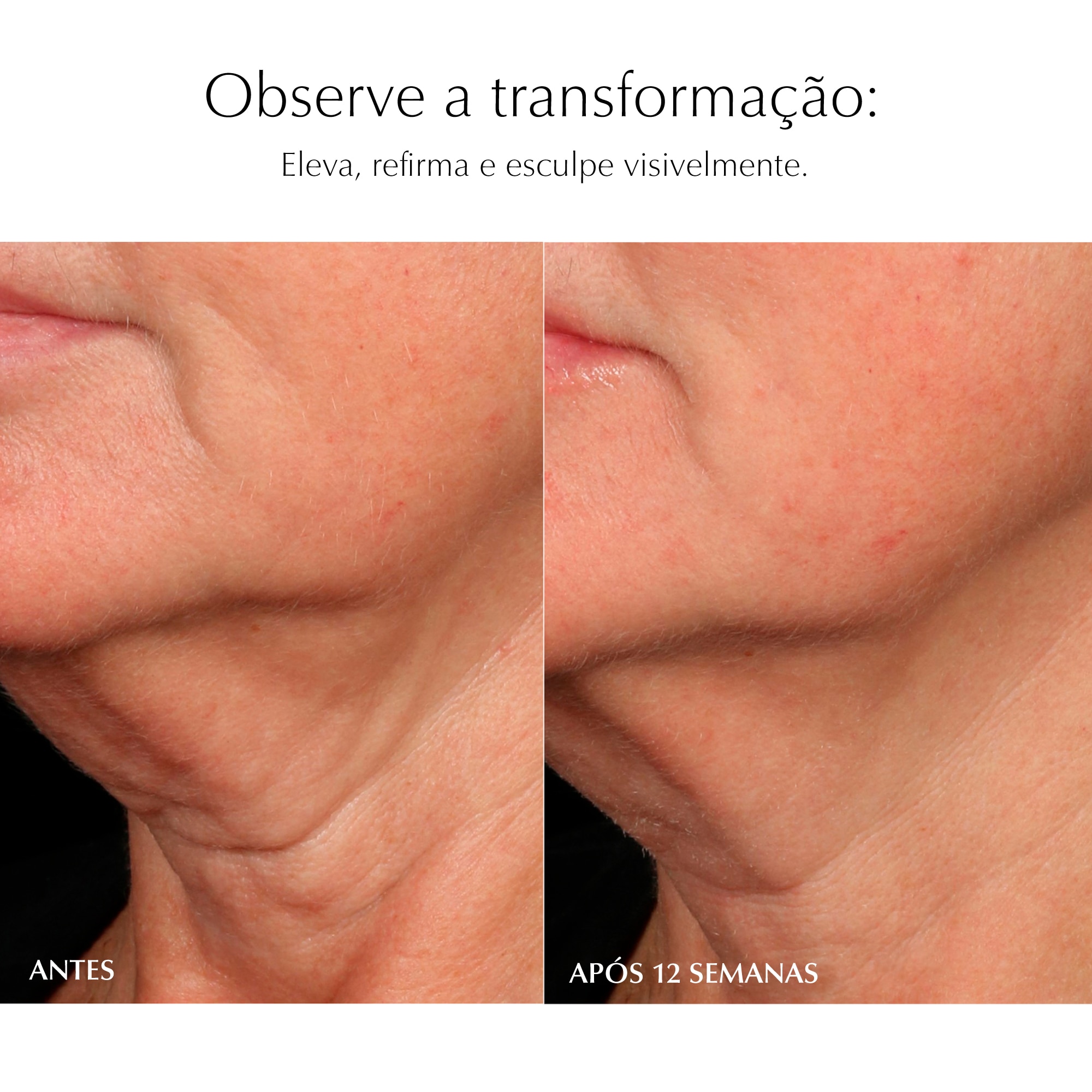 Sérum Remodelador e Revitalizante Supreme+ 4