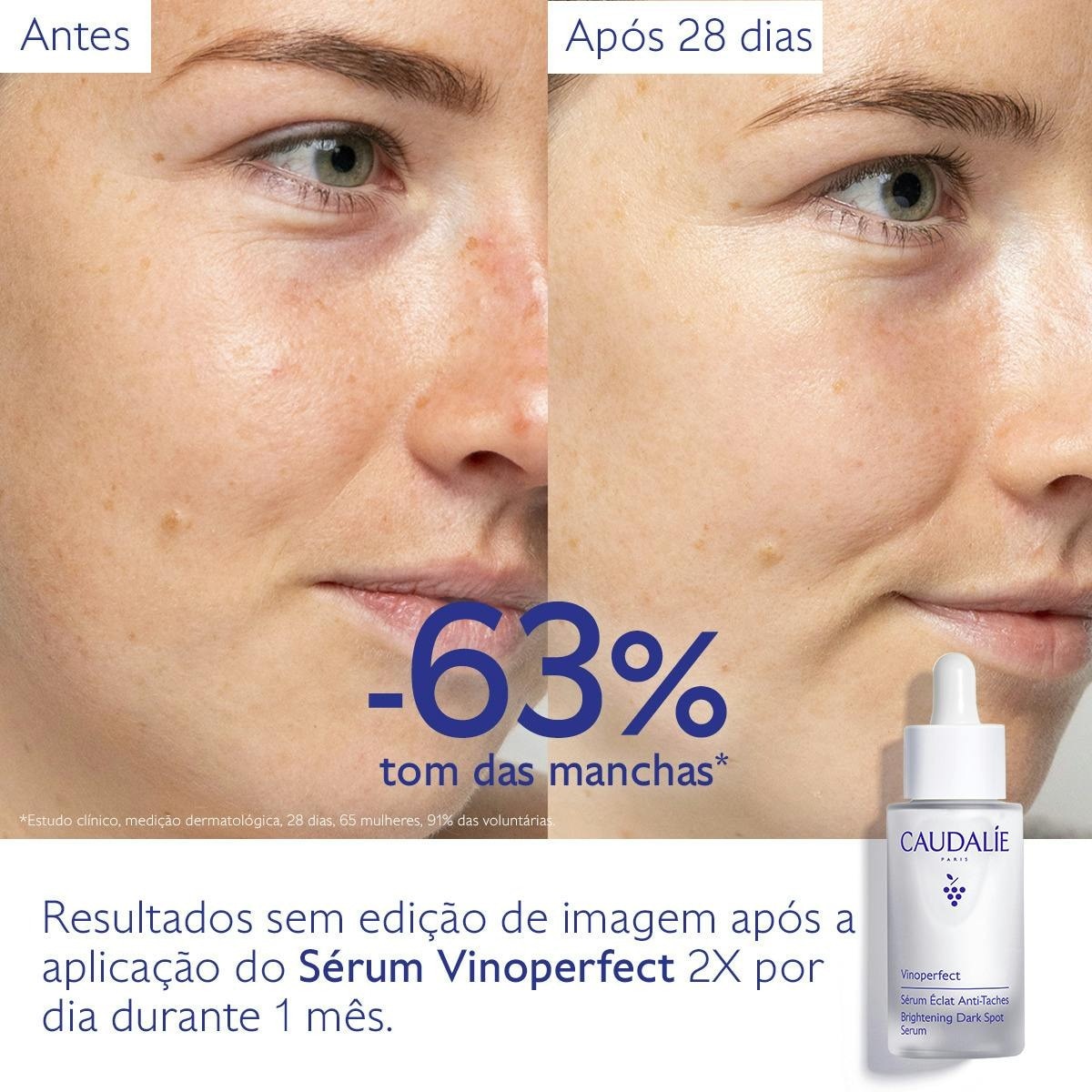 Sérum Luminosidade Antimanchas Vinoperfect 30ml Caudalie 5