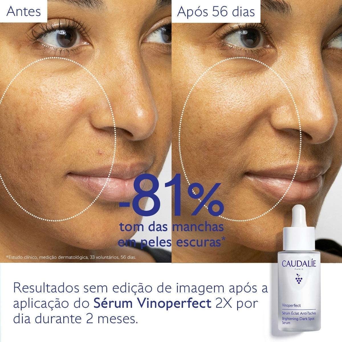 Sérum Luminosidade Antimanchas Vinoperfect 30ml Caudalie 6