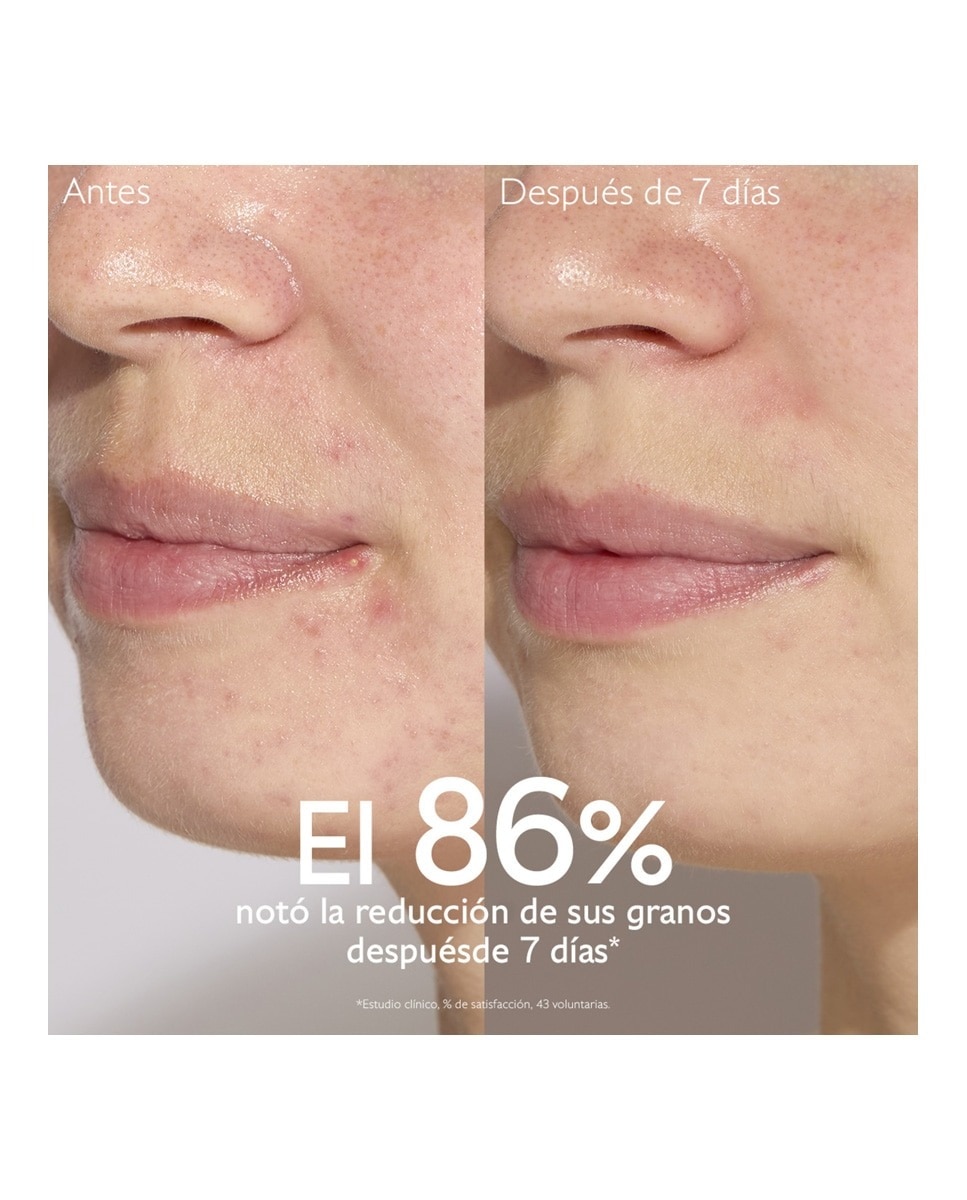 Sérum Salicílico Anti-imperfeições Vinopure Caudalie 4