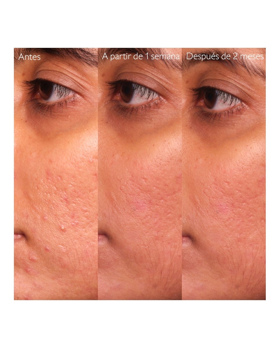 Sérum Salicílico Anti-imperfeições Vinopure Caudalie 6