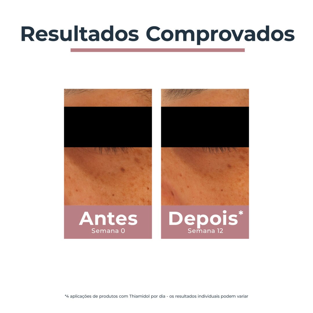 Creme Contorno de Olhos Iluminador Antiolheiras Anti-Pigment - 15 ml 6