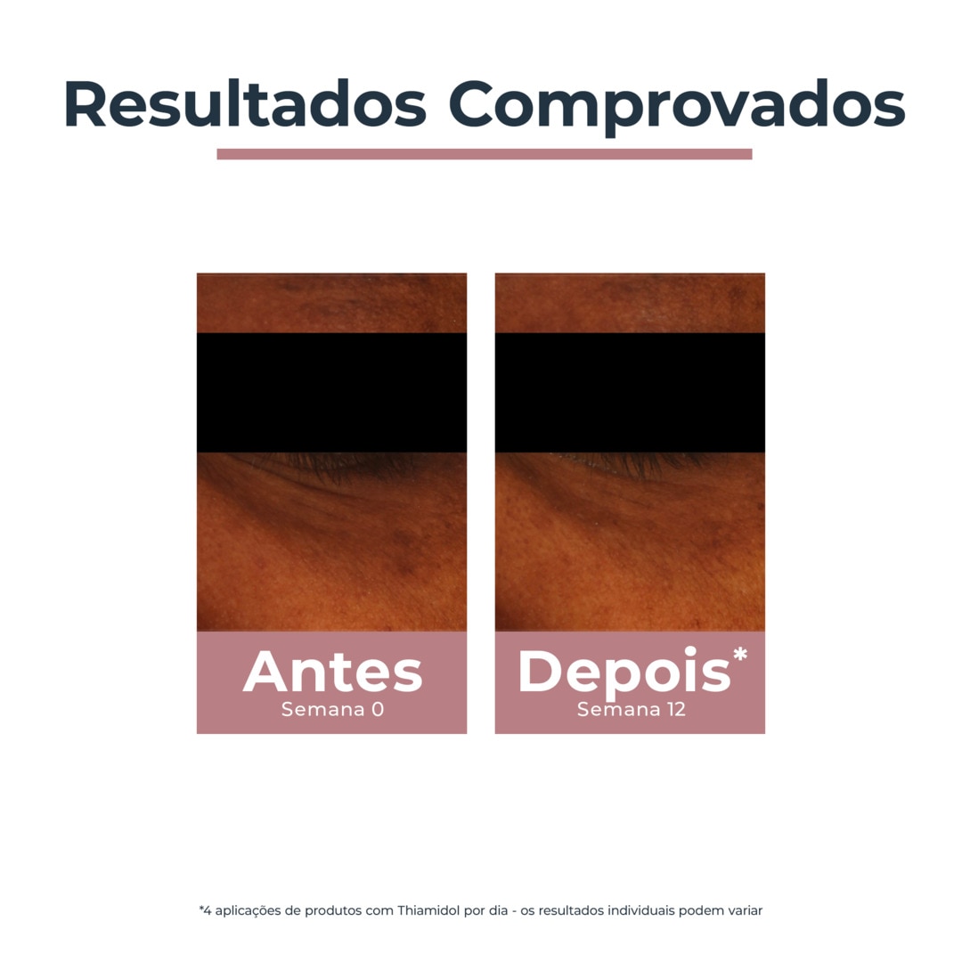 Creme Contorno de Olhos Iluminador Antiolheiras Anti-Pigment - 15 ml 7