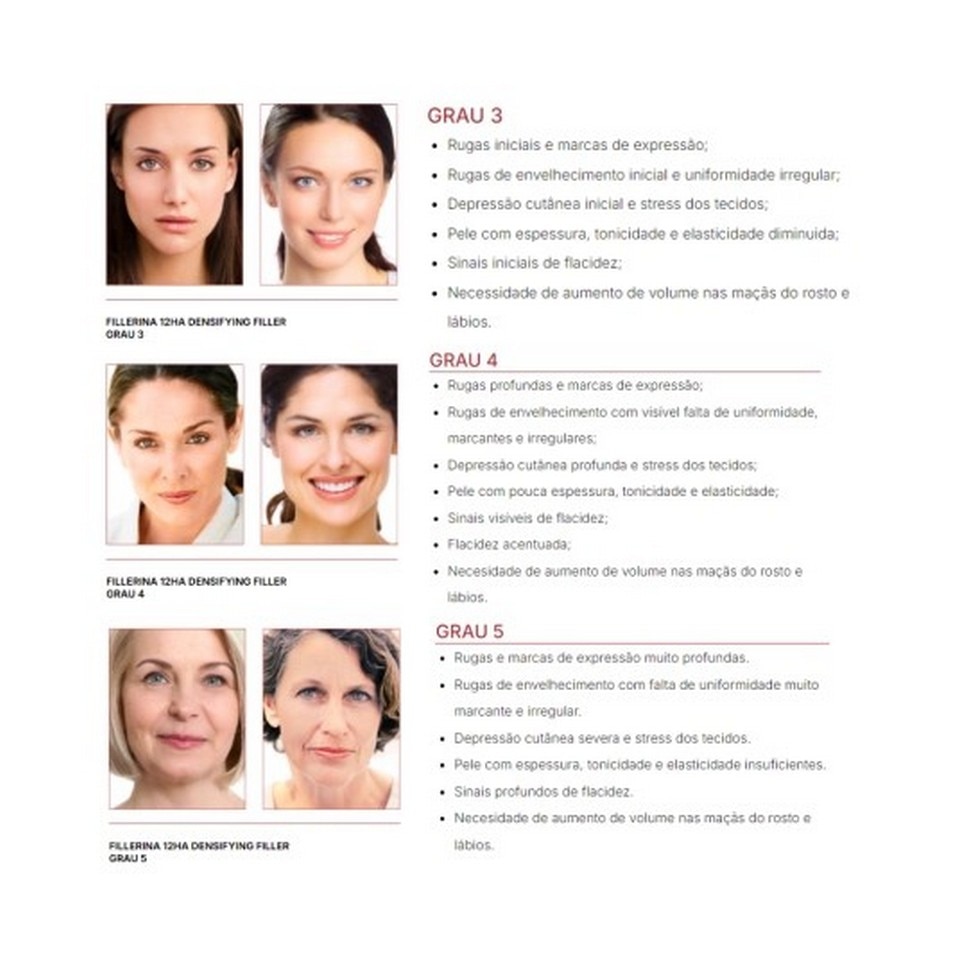 Densifying-Filler Tratamento Intensivo Grau 3 4