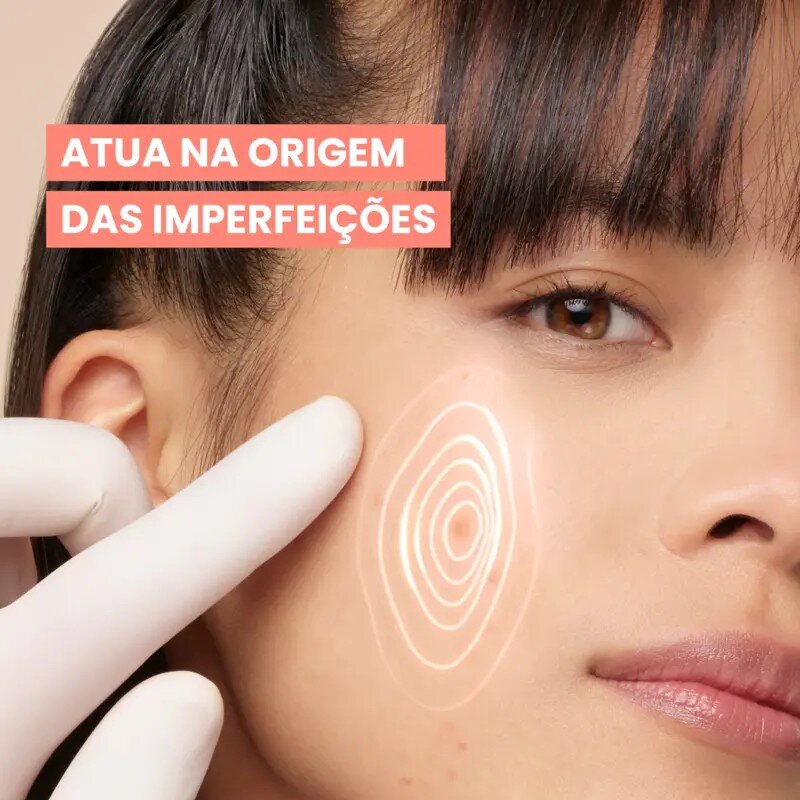 Gel-Creme Cuidado Intensivo Anti-imperfeições Cleanance Comedomed+ 4