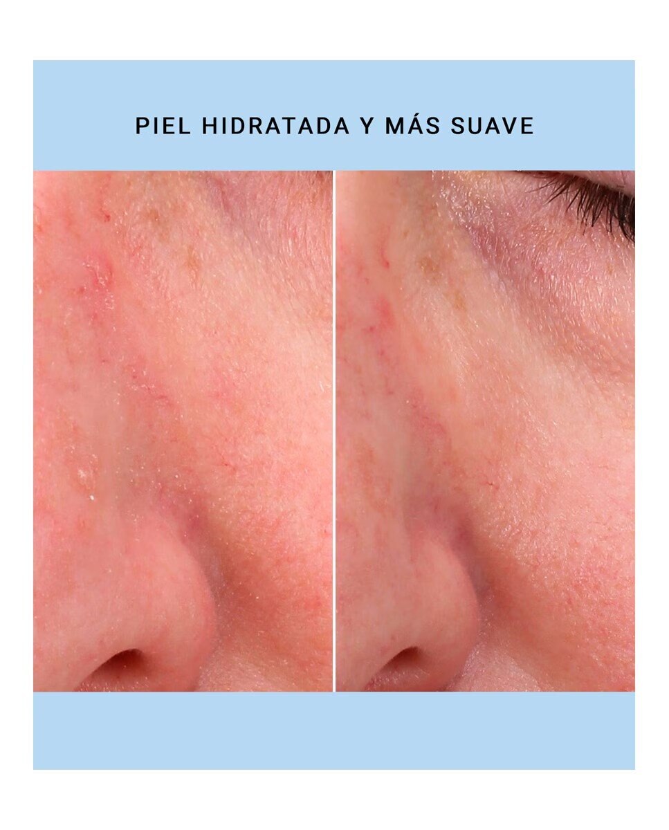 Óleo Hidratante Bifásico 9