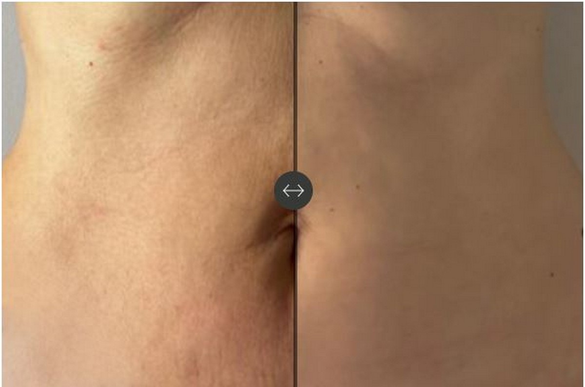 Unicbody Slim Action x 4 - 200 ml 7