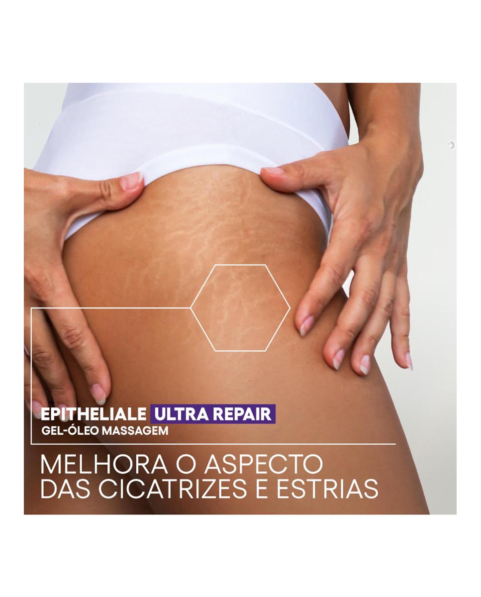 Gel-óleo de Massagem EPITHELIALE Antimarcas 100 ml 5