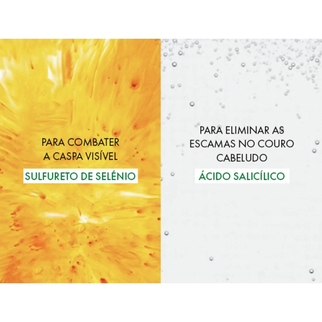 Champô Anticaspa Dercos Technique 5
