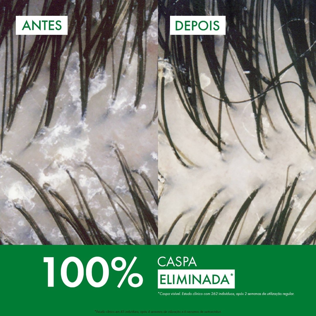 Champô Anticaspa Dercos Technique 6