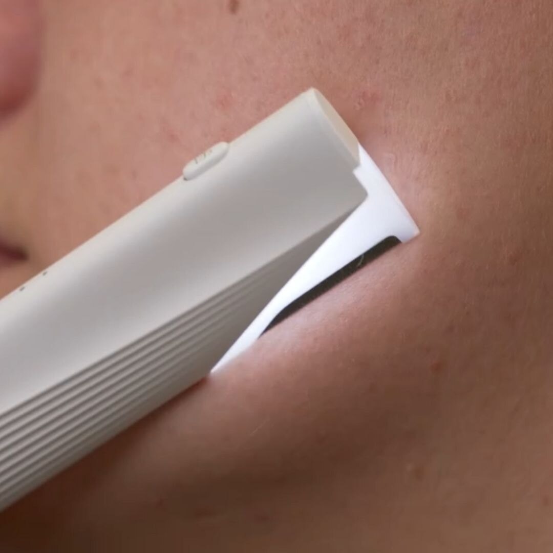 2-in-1 Light Up Sonic Dermaplane 4