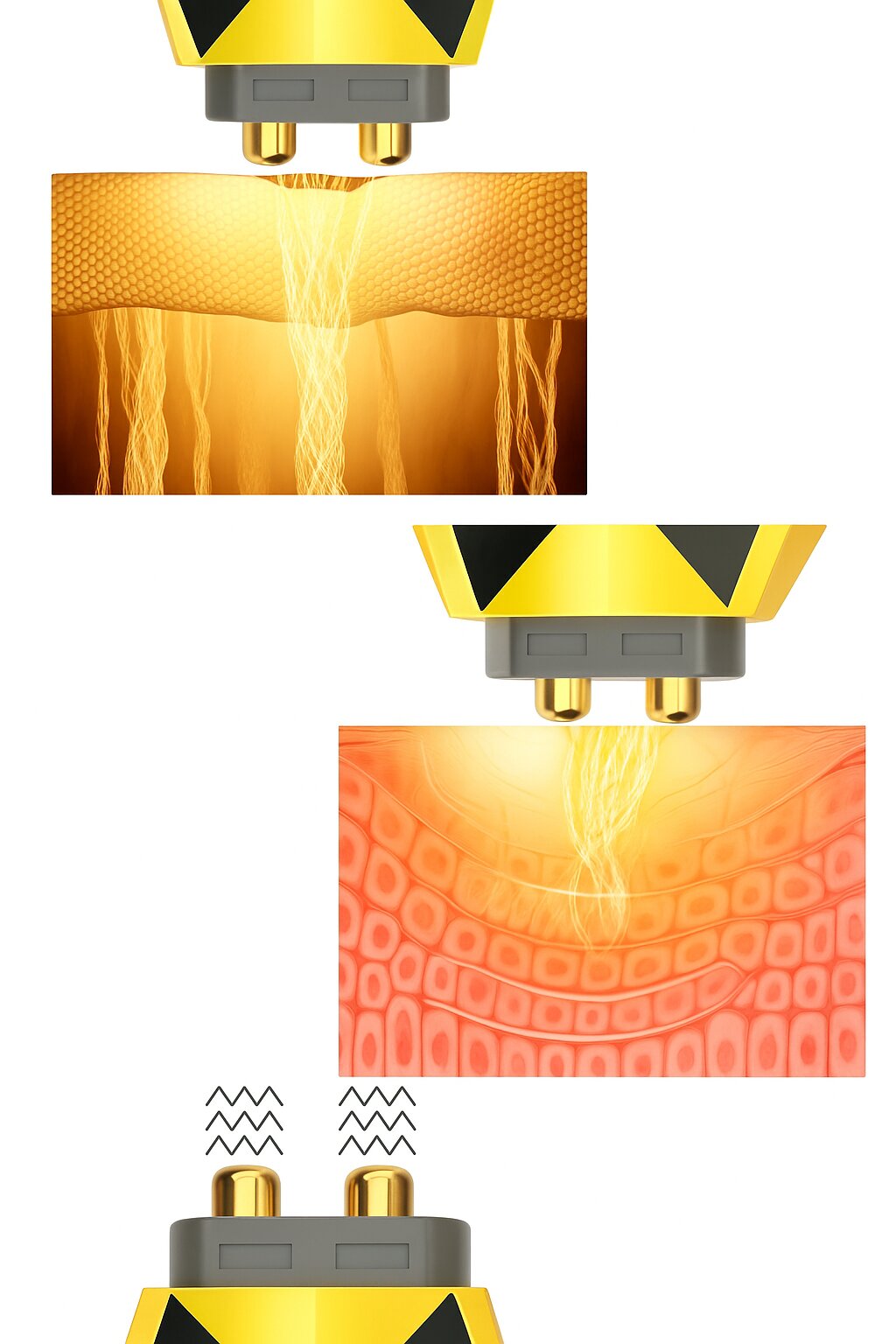 Dispositivo de Radiofrequência para Reafirmar A Pele, Combater As Rugas e o Envelhecimento Drakefor DKF-DIAMOND RF EMS FOTON FACIAL Amarelo-4