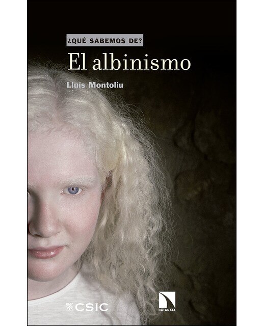 El Albinismo 1