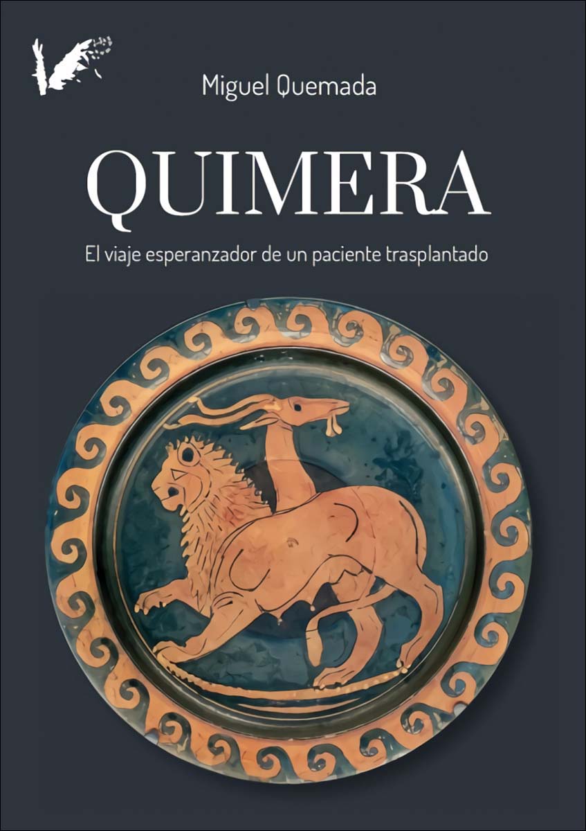 Imagem 0 de Quimera: El viaje esperanzador de un paciente trasplantado