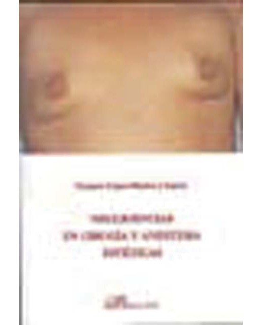 Negligencias en cirugía y anestesia estéticas(Tapa blanda) 1