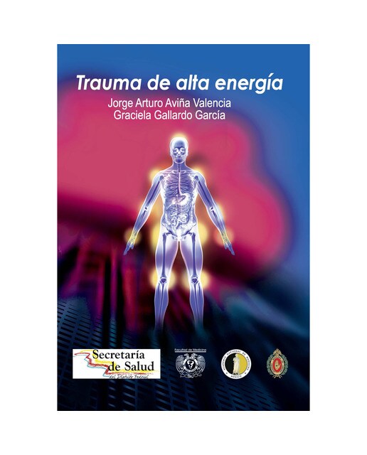 Trauma de alta energía 1