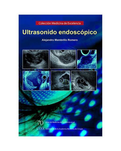 Ultrasonido endoscópico 1