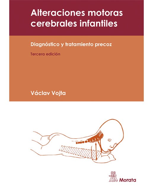 Alteraciones motoras cerebrales infantiles: DIAGNÓSTICO Y TRATAMIENTO PRECOZ (Capa mole) 1