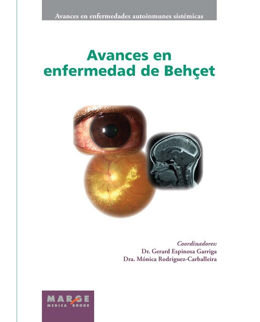 Avances en enfermedad de Behçet (Capa dura) 1