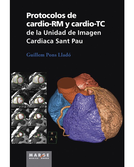 Protocolos de cardio-RM y cardio-TC de la Unidad de Imagen Cardiaca Sant Pau 1