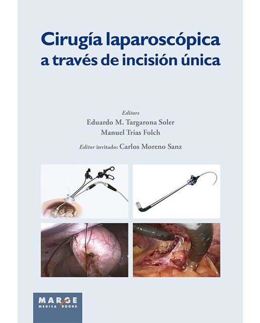 Cirugía laparoscópica a través de incisión única(Tapa blanda) 1