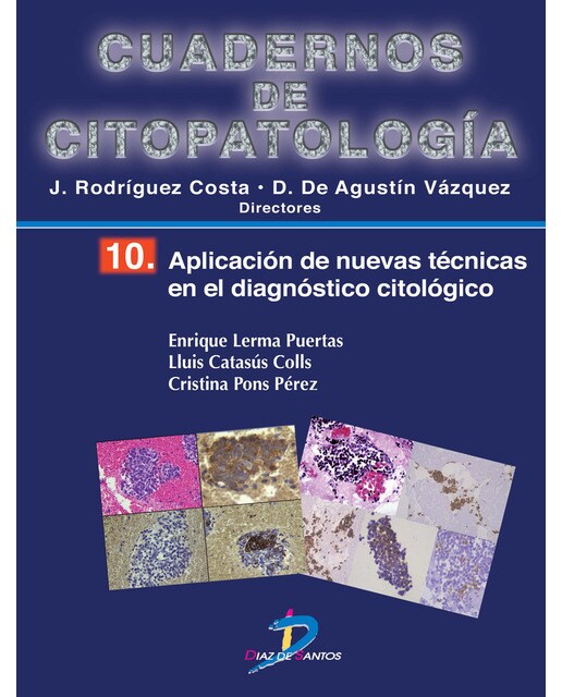 Aplicación de nuevas técnicas en el diagnóstico citológico: Cuadernos de citopatologia-10 (Capa mole) 1