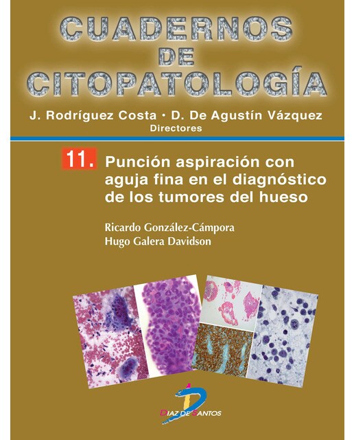 Imagem 0 de Punción aspiración con aguja fina en el diagnósitco de los tumores de los tejidos blandos: Cuadernos de citopatologia-8 (Capa mole)