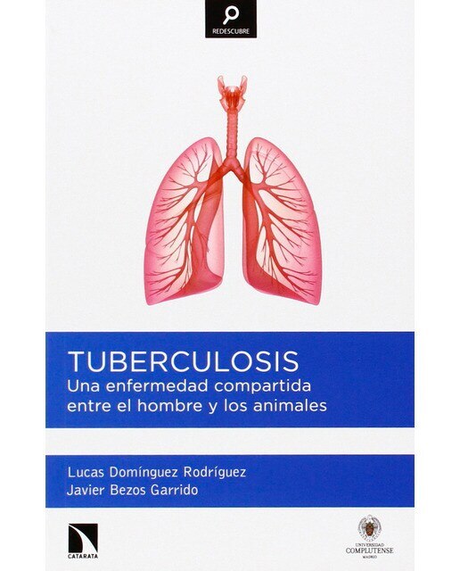 Tuberculosis: Una enfermedad compartida entre el hombre y los animales (Capa mole) 1