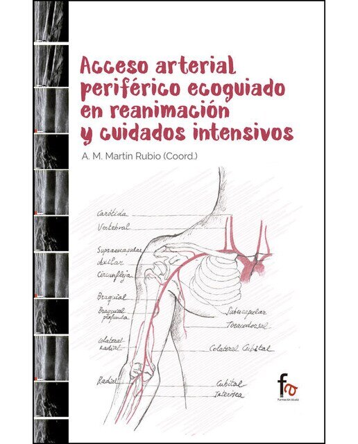 Imagen 0 de Acceso arterial periférico ecoguiado en reanimación y ciudad (Tapa blanda)