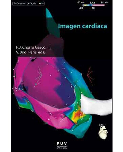 Imagen 0 de Imagen cardiaca (Tapa blanda)