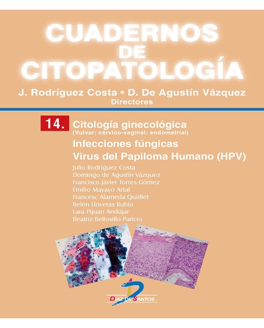 Citología Ginecológica: Infecciones Fúngicas. Virus 1