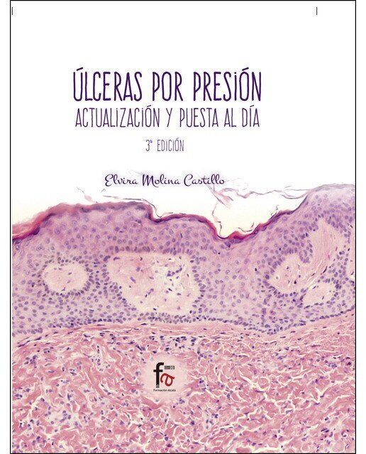 Ùlceras por presión. Actualización y puesta al día