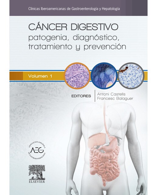 Cáncer digestivo: patogenia, diagnóstico, tratamiento y prevención