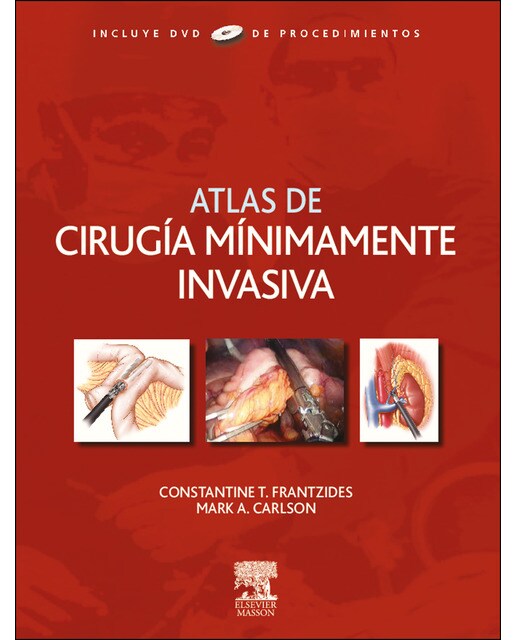 Atlas de cirugía mínimamente invasiva + dvd-rom