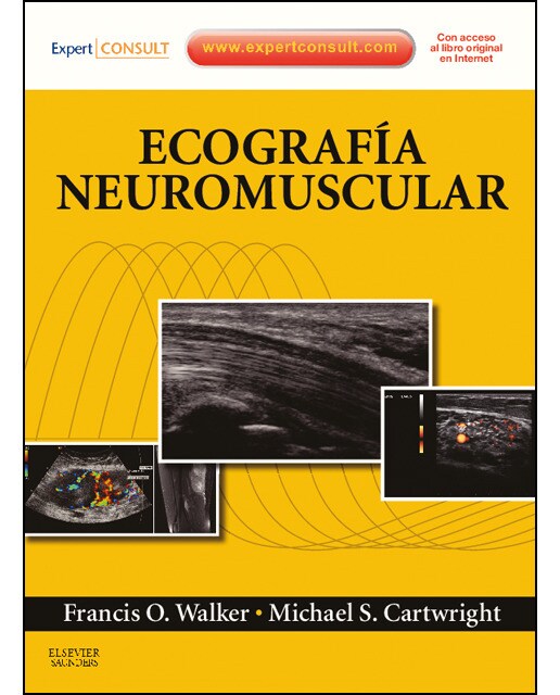 Ecografía neuromuscular + expertconsult