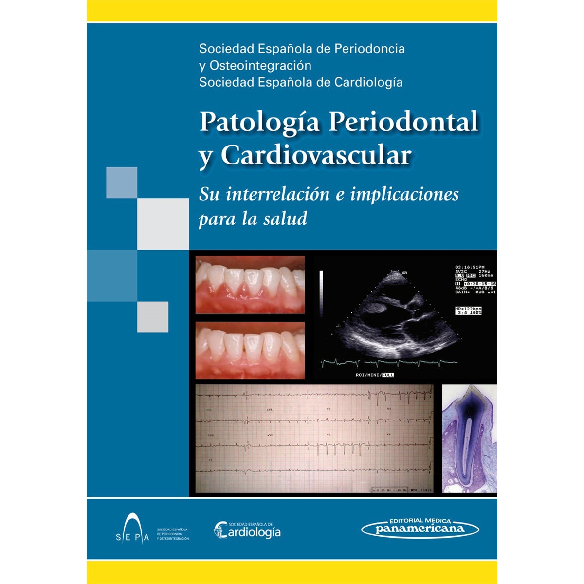 Patolog. Peridontal y Cardiov.: Patología Periodontal y Cardiovascular