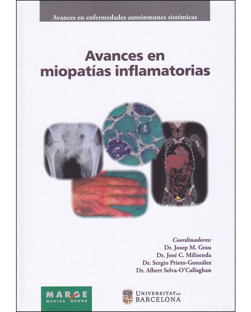 Avances en miopatías inflamatorias(Tapa blanda) 1
